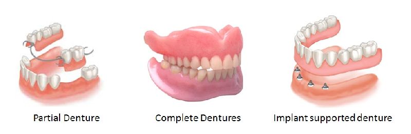 denture in karaikudi