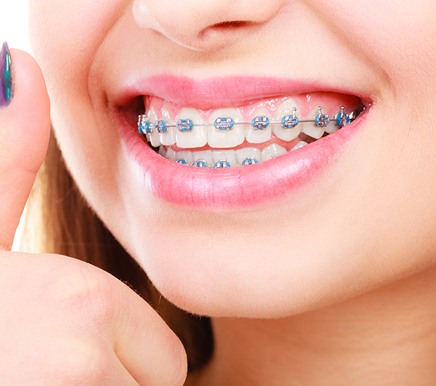 Orthodontic Treatment in Karaikudi