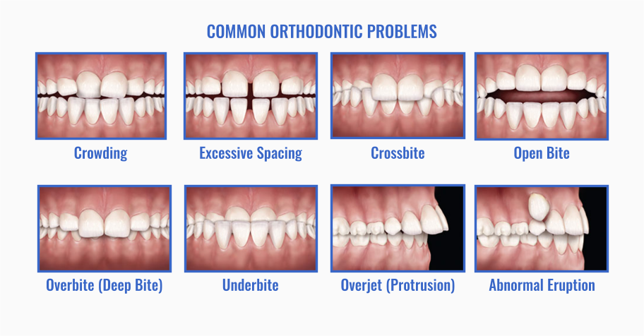 ortho