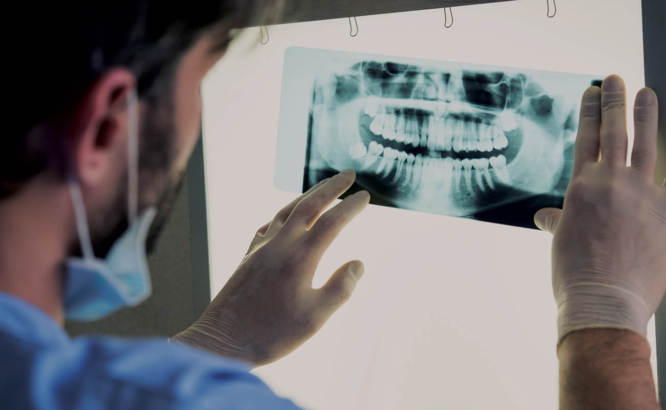 Tooth X-ray in karaikudi